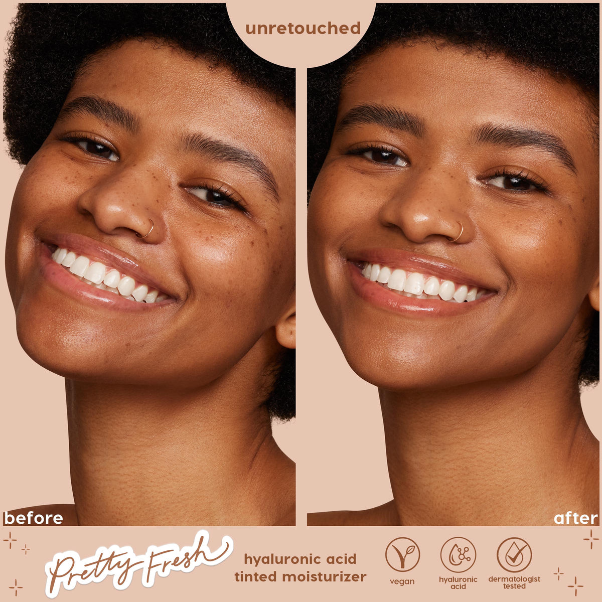 Smiling model shows before-and-after of ColourPop Pretty Fresh Tinted Moisturizer in Medium Dark 14 W, with freckles softened, tone evened, and dewy glow; split screen marked unretouched on warm beige background with vegan and hyaluronic acid icons.