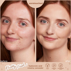 Split-screen model face shows before-and-after coverage using ColourPop Pretty Fresh Creamy Concealer in Fair 05 W, blurring redness and evening skin tone; unretouched results with hyaluronic acid formula, vegan and dermatologist tested.