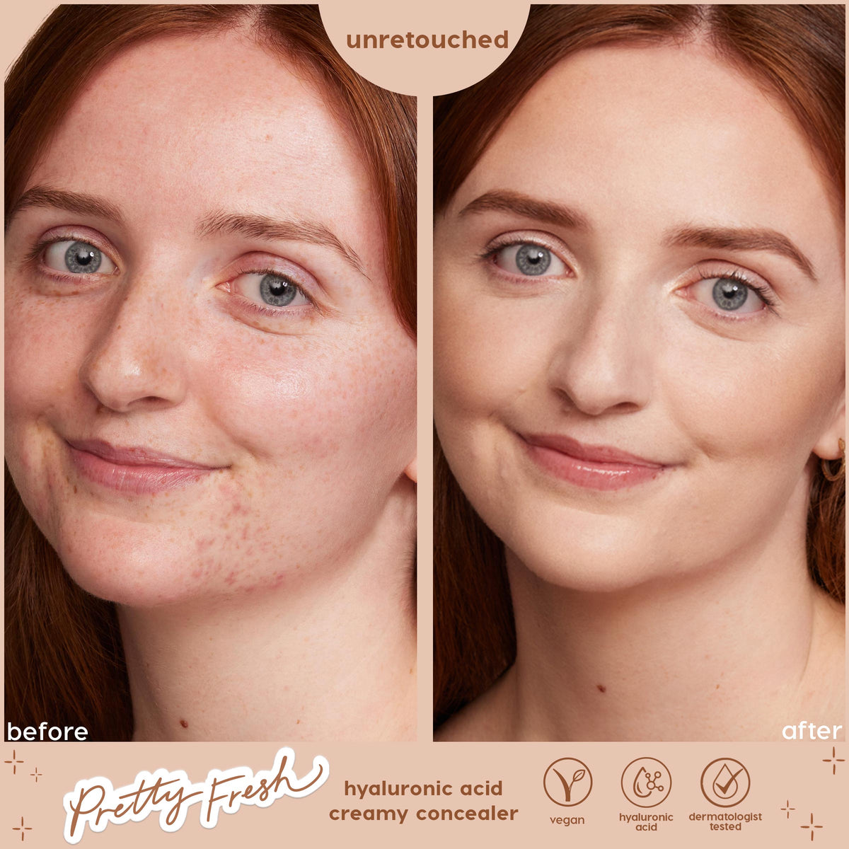 Split-screen model face shows before-and-after coverage using ColourPop Pretty Fresh Creamy Concealer in Fair 05 W, blurring redness and evening skin tone; unretouched results with hyaluronic acid formula, vegan and dermatologist tested.