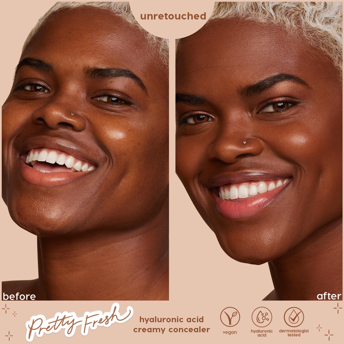 Deep Dark 200 N Pretty Fresh Creamy Concealer evening tone and softening dark circles on a smiling model; side-by-side before and after shows a natural, unretouched finish; ColourPop Pretty Fresh Creamy Concealer with hyaluronic acid.